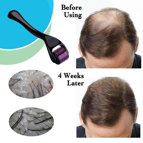 Derma Roller | Titanium Alloy Needles For Hair Growth
