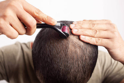 Derma Roller | Titanium Alloy Needles For Hair Growth